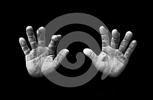 Deformed hands of a farmer