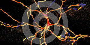 Degeneration of dopaminergic neuron, a key stage of development of Parkinson`s disease