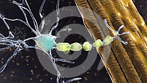 Degradation of motor neurons, conceptual 3D illustration photo