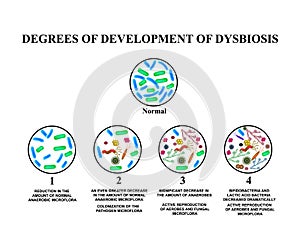 4 degrees of development of dysbiosis. Dysbacteriosis of the intestine. large intestine. dysbiosis colon. Bacteria, fungi, viruses photo