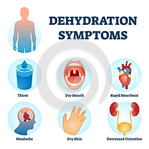 Dehydration symptoms vector illustration. Water deficit diagnosis scheme. photo