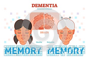 Dementia or alzheimer`s disease concept vector illustration diagram with young and old woman.