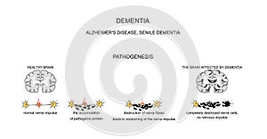 Dementia, Alzheimer's disease. pathogenesis