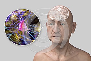 Dementia, conceptual illustration, computer illustration