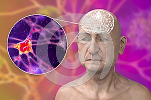 Dementia, conceptual illustration, computer illustration