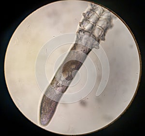 Demodex folliculorum - parasitic mite on the eyelashes of a human eye photo