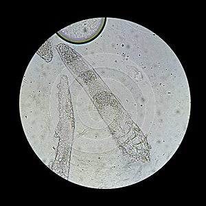 Demodex mite from a microscope view. The parasite causing a skin disease -Demodecosis
