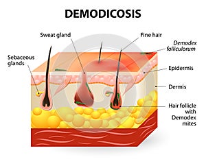 Demodicosis. Demodex mite