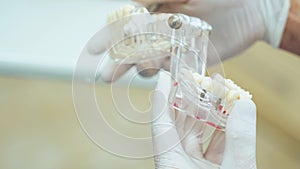 Demonstration of false teeth of implants on the layout of the jaw.