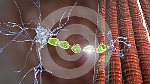 Demyelination of a neuron, the damage of the neuron myelin sheath seen in demyelinating diseases