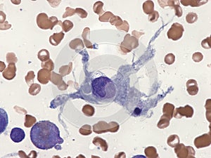 Dendritic cell in bone marrow.