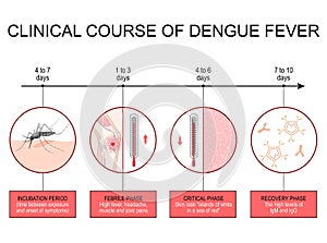 Dengue fever. Clinical course infographics