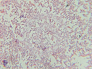 Dense Clumps of Rod-Shaped Bacteria (Bacilli) Under a Microscop