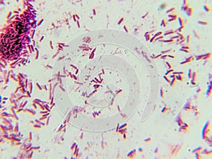 Dense Clumps of Rod-Shaped Bacteria (Bacilli) Under a Microscop