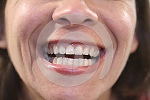 Dentale 