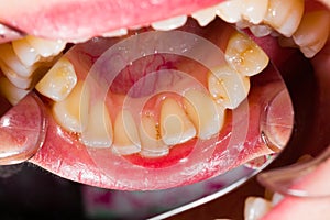 Dental anatomy