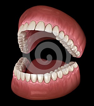 Dental anatomy - Opened Dentures. Medically accurate dental photo