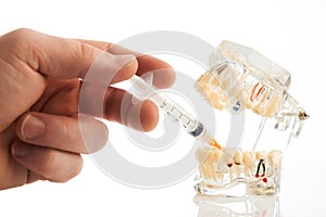 Dental anesthesia concept, close-up