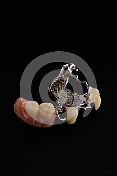 Dental appliances and dental prostheses.