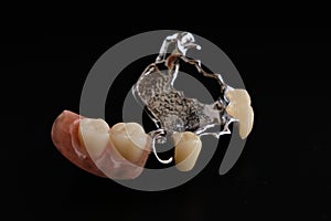 Dental appliances and dental prostheses.