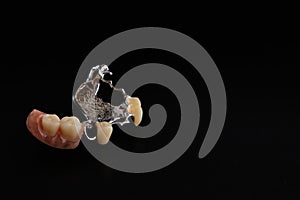 Dental appliances and dental prostheses.