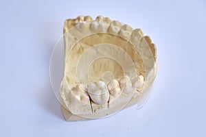 Dental appliances and dental prostheses.