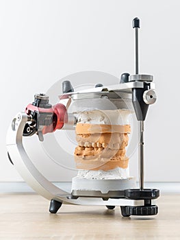 dental articulator with dental gypsum prosthesis model in dental laboratory