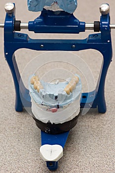 Dental articulator with plastered dental  models