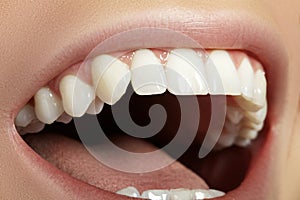 Dental Beauty. Beautiful Macro with perfect White Teeth. Fashion Lips Natural Make-up. Whitening Tooth, Wellness