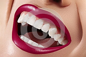 Dental Beauty. Beautiful Macro with perfect White Teeth. Fashion Lips Red Make-up. Whitening Tooth, Wellness Treatment