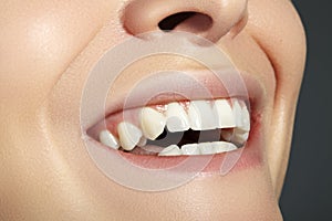 Dental Beauty. Beautiful Macro with perfect White Teeth. Fashion Lips Red Make-up. Whitening Tooth, Wellness Treatment