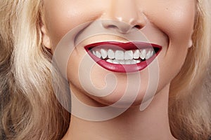 Dental Beauty. Beautiful Macro of perfect White Teeth. Sexy Fashion Lip Red Makeup. Whitening Tooth, Wellness Treatment