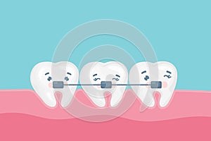 Dental braces vector poster banner template. Cute happy teeth with metal braces. Orthodontic treatment, bite correction
