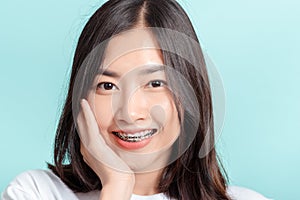 Dental braces of young asian woman wearing braces beauty smile with white teeth