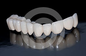 Dental bridge