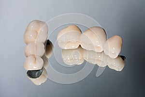 Dental bridge