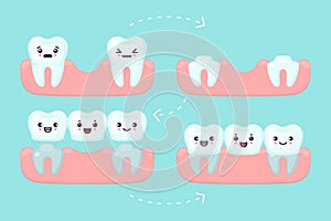 Dental bridge setting, tooth stomatology vector concept illustration