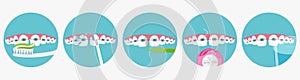 Daily dental care for braces, oral hygiene, orthodontics concept, vector illustration.