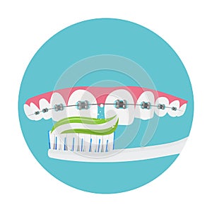 Daily dental care for braces, oral hygiene, orthodontics concept, vector illustration.