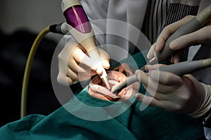 Dental care check up, Dentist examining and doing teeth treatment in dental clinic, Yearly visit for teeth cleaning and scaling.