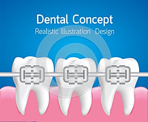 Dental care concept, Realistic Vector