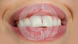 Dental care, healthy teeth and smile, white teeth in mouth. Closeup of smile with white healthy teeth. Open mouth.