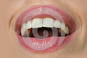 Dental care, healthy teeth and smile, white teeth in mouth. Closeup of smile with white healthy teeth. Smiling mouthes