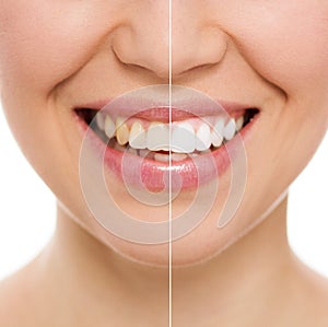 Zubná starostlivosť žena 