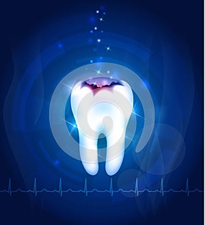 Dental caries abstract blue background
