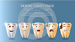 Dental caries stage vector poster banner template