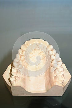 Dental cast