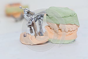 Dental cast model
