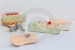 Dental cast model