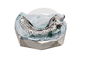 Dental cast moulds on a white background